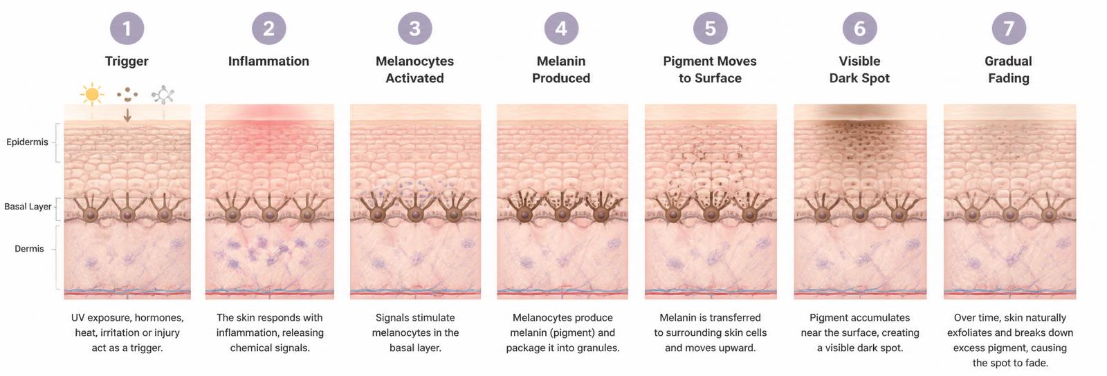 Diagram of seven stages of skin pigmentation